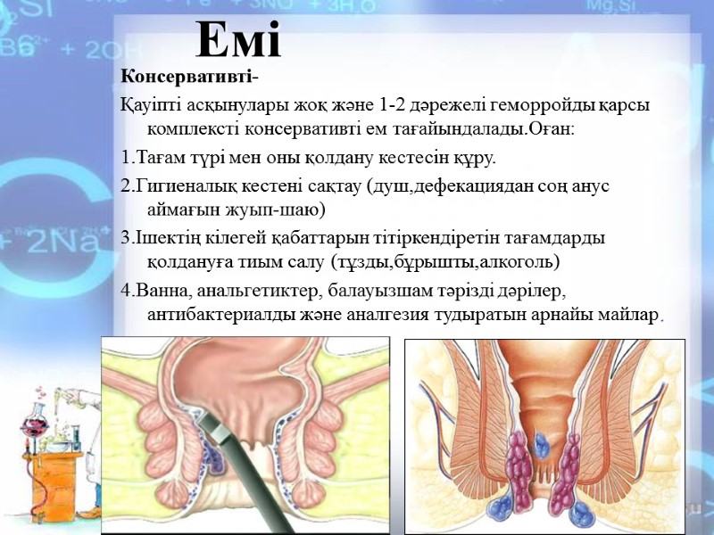 Емі   Консервативті- Қауіпті асқынулары жоқ және 1-2 дәрежелі геморройды қарсы комплексті консервативті